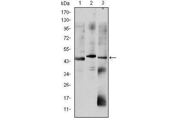 OTX2 antibody