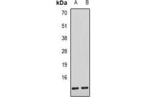 Western blot analysis of AHSP expression in mouse liver (A), rat liver (B) whole cell lysates. (aHSP antibody)