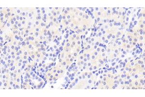 Immunohistochemistry (IHC) image for anti-TIMP Metallopeptidase Inhibitor 4 (TIMP4) (AA 32-224) antibody (ABIN7431146)