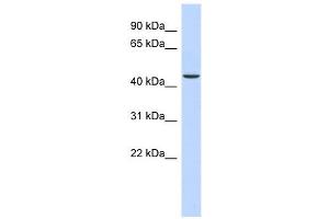 OGDH antibody used at 1 ug/ml to detect target protein. (alpha KGDHC antibody  (N-Term))