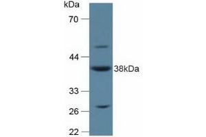 Detection of ANXA2 in Rat Placenta Tissue using Polyclonal Antibody to Annexin A2 (ANXA2) (Annexin A2 antibody  (AA 1-339))