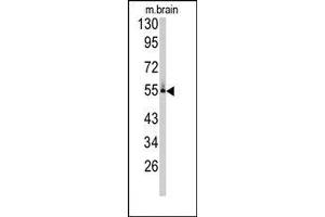 Image no. 1 for anti-Cytochrome P450, Family 26, Subfamily C, Polypeptide 1 (CYP26C1) (C-Term) antibody (ABIN360260) (CYP26C1 antibody  (C-Term))