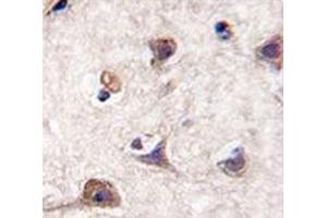 IHC analysis of FFPE human brain tissue stained with LC3 antibody (MAP1LC3A antibody  (AA 1-30))