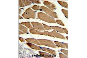 Formalin-fixed and paraffin-embedded human skeletal muscle reacted with ACTR2 Antibody , which was peroxidase-conjugated to the secondary antibody, followed by DAB staining. (ACTR2 antibody  (AA 191-219))
