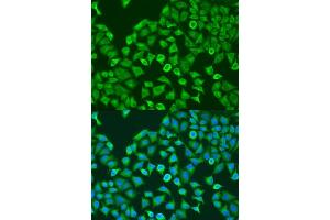 Immunofluorescence analysis of U2OS cells using Pumilio 1 antibody  at dilution of 1:100. (PUM1 antibody  (AA 1-280))