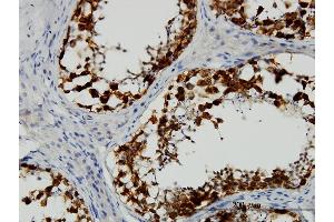 Immunoperoxidase of monoclonal antibody to DAZ1 on formalin-fixed paraffin-embedded human testis. (DAZ1 antibody  (AA 21-120))