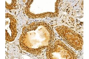 ABIN6262635 and ABIN6273051 at 1/100 staining Human normal tissues adjacent to breast cancer by IHC-P.