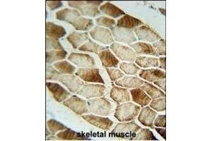 SAR1B antibody (Center) (ABIN654355 and ABIN2844120) immunohistochemistry analysis in formalin fixed and paraffin embedded human skeletal muscle followed by peroxidase conjugation of the secondary antibody and DAB staining. (SAR1B antibody  (AA 89-116))