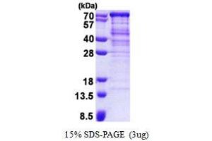 Alveolar Soft Part Sarcoma Chromosome Region, Candidate 1 (ASPSCR1) (AA 1-553) protein (His tag)