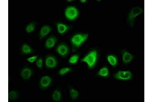 Immunofluorescence staining of A549 cells with ABIN7176339 at 1:166, counter-stained with DAPI. (ZNF488 antibody  (AA 1-200))