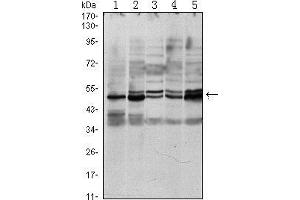 Western blot analysis using SMAD3 mouse mAb against A549 (1), Hela (2), Jurkat (3), PC-2 (4) and NIH/3T3 (5) cell lysate. (SMAD3 antibody)