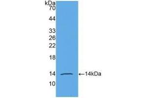 Detection of Recombinant AMH, Human using Monoclonal Antibody to Anti-Mullerian Hormone (AMH) (AMH antibody  (AA 453-560))