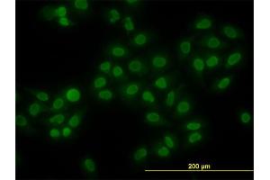 Immunofluorescence (IF) image for anti-High Mobility Group Box 1 (HMGB1) (AA 1-90) antibody (ABIN561286)