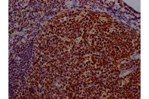 Immunohistochemistry (IHC) image for anti-Ubiquitin Specific Peptidase 7 (Herpes Virus-Associated) (USP7) antibody (ABIN7127535)