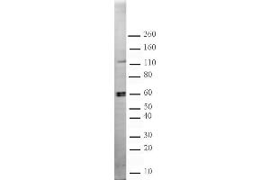 CARM1 pAb tested by Western blot.