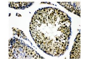 IHC analysis of KDM5B using anti-KDM5B antibody (ABIN4886648). (KDM5B antibody  (Middle Region))