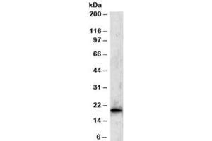 Western blot testing of Jurkat lysate with TBPL1 antibody at 2ug/ml. (TBPL1 antibody)