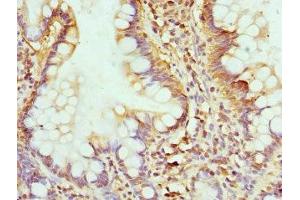 Immunohistochemistry of paraffin-embedded human small intestine tissue using ABIN7154289 at dilution of 1:100 (GMP Synthase antibody  (AA 394-693))