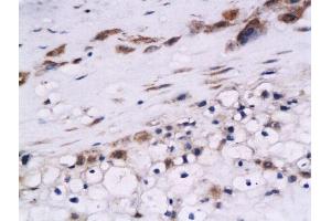Formalin-fixed and paraffin embedded human placenta labeled with Anti-Cystatin B Polyclonal Antibody, Unconjugated  at 1:200 followed by conjugation to the secondary antibody and DAB staining (CSTB antibody  (AA 51-98))