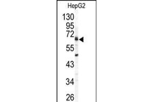 Western blot analysis of ARSB antibody (C-term) (ABIN391670 and ABIN2841581) in HepG2 cell line lysates (35 μg/lane). (Arylsulfatase B antibody  (C-Term))