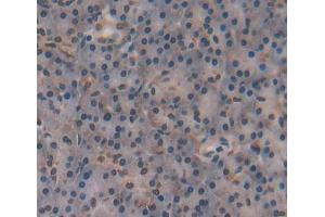 Immunohistochemistry (IHC) image for anti-Nuclear Receptor Subfamily 5, Group A, Member 2 (NR5A2) (AA 300-541) antibody (ABIN1869034)