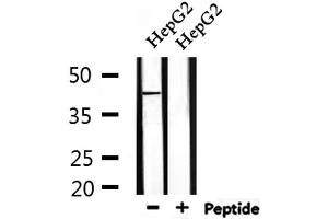 Western Blotting (WB) image for anti-Parkinson Protein 7 (PARK7) (C-Term) antibody (ABIN6264038)