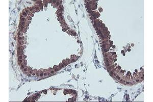 Immunohistochemical staining of paraffin-embedded Human breast tissue using anti-ACY1 mouse monoclonal antibody. (Aminoacylase 1 antibody)