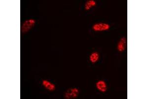 Immunofluorescent analysis of Histone Deacetylase 3 staining in HeLa cells. (HDAC3 antibody  (C-Term))