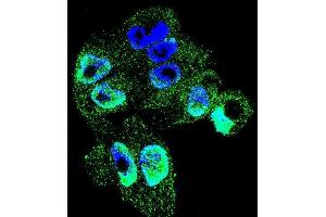 Confocal immunofluorescent analysis of TI Antibody (C-term) (ABIN655149 and ABIN2844770) with  cell followed by Alexa Fluor 488-conjugated goat anti-rabbit lgG (green). (TIMP1 antibody  (C-Term))