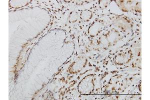 Immunoperoxidase of monoclonal antibody to POLK on formalin-fixed paraffin-embedded human stomach. (POLK antibody  (AA 1-472))