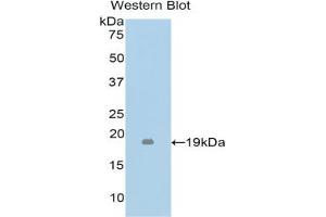 Detection of Recombinant TNFb, Mouse using Polyclonal Antibody to Tumor Necrosis Factor Beta (TNFb) (LTA antibody  (AA 49-202))