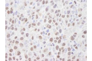 Immunohistochemistry (IHC) image for anti-Histone Deacetylase 2 (HDAC2) (C-Term) antibody (ABIN7448973) (HDAC2 antibody  (C-Term))