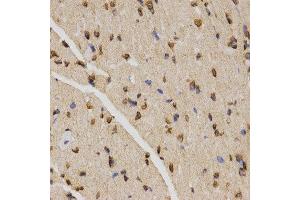 Immunohistochemistry (IHC) image for anti-Histone H4 (3meLys20) antibody (ABIN6219533) (Histone H4 antibody  (3meLys20))