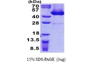 alpha- and gamma-Adaptin Binding Protein (AAGAB) (AA 1-315) protein (His tag)