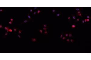 ABIN6266612 staining A-431 cells by IF/ICC. (p63 antibody  (C-Term))
