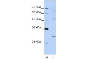 EXOSC4 antibody used at 5 ug/ml to detect target protein.