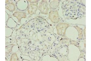 Immunohistochemistry of paraffin-embedded human kidney tissue using ABIN7159886 at dilution of 1:100 (TIMM1B (AA 1-103) antibody)