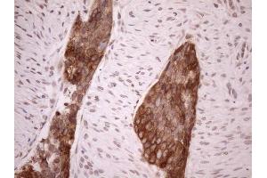 Immunohistochemistry (IHC) image for anti-Achalasia, Adrenocortical Insufficiency, Alacrimia (AAAS) (AA 322-546) antibody (ABIN2715861) (Adracalin antibody  (AA 322-546))