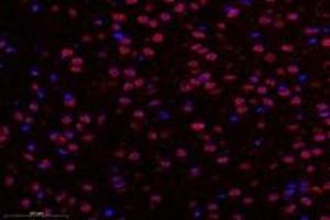 Immunofluorescent analysis of paraformaldehyde-fixed rat substantia nigra using TBXT (ABIN7075815) at dilution of 1: 600 (T-Box 19 antibody)