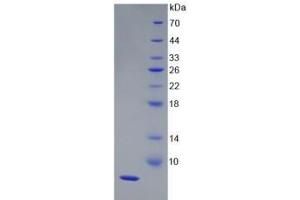 SDS-PAGE analysis of Human HPR Protein. (HPR Protein)