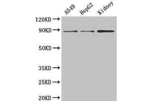 Western Blot Positive WB detected in: A549 whole cell lysate, HepG2 whole cell lysate, Mouse kidney tissue All lanes: ASPH antibody at 3 μg/mL Secondary Goat polyclonal to rabbit IgG at 1/50000 dilution Predicted band size: 86, 35, 26, 24, 34, 84, 30, 22, 29, 33 kDa Observed band size: 86 kDa (Aspartate beta Hydroxylase antibody  (AA 75-270))