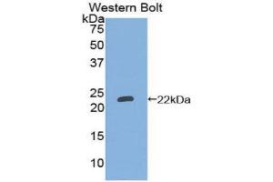 Western Blotting (WB) image for anti-Linker For Activation of T Cells Family, Member 2 (LAT2) (AA 32-192) antibody (ABIN1859617)