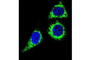 Confocal immunofluorescent analysis of BCL10 Antibody (N-term) (ABIN654655 and ABIN2844351) with Hela cell followed by Alexa Fluor 488-conjugated goat anti-rabbit lgG (green).