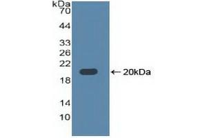Detection of Recombinant TLR3, Human using Polyclonal Antibody to Toll Like Receptor 3 (TLR3) (TLR3 antibody  (AA 404-532))
