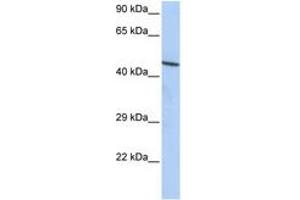 Image no. 1 for anti-Zinc Finger Protein 830 (ZNF830) (AA 72-121) antibody (ABIN6742650) (CCDC16 antibody  (AA 72-121))