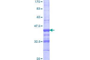 AEBP1 Protein (AA 912-1013) (GST tag)
