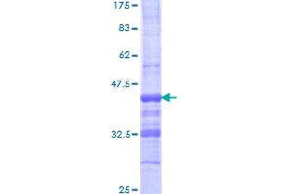 AEBP1 Protein (AA 912-1013) (GST tag)