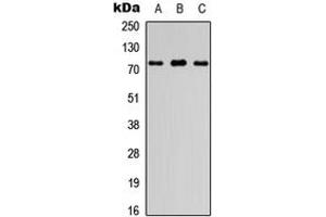 Western blot analysis of FIGNL1 expression in HEK293T (A), Raw264. (FIGNL1 antibody  (Center))