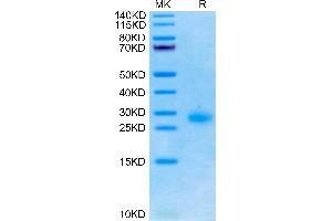 TNFRSF18 Protein (AA 20-156) (His tag)