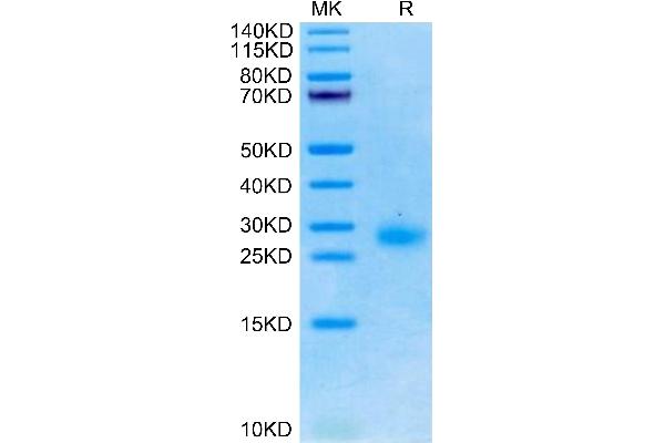 TNFRSF18 Protein (AA 20-156) (His tag)